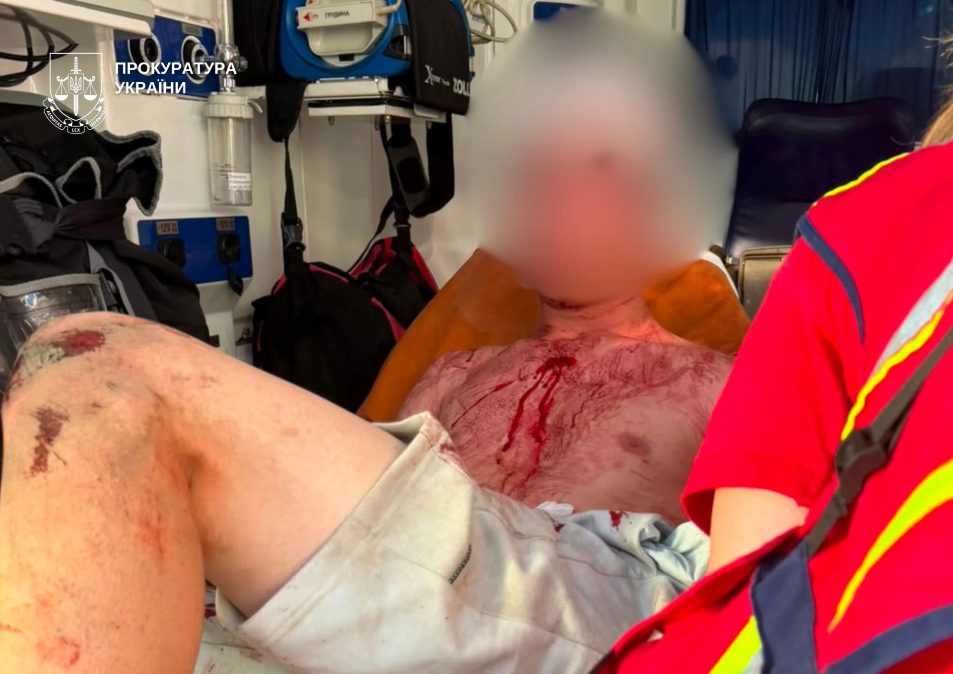 У Києві повідомили про підозру 19-річному студенту, який поранив ножем трьох перехожих